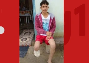 Pé de servidor que amputou o próprio membro para receber R$ 1,5 milhão foi encontrado dentro da mochila dele