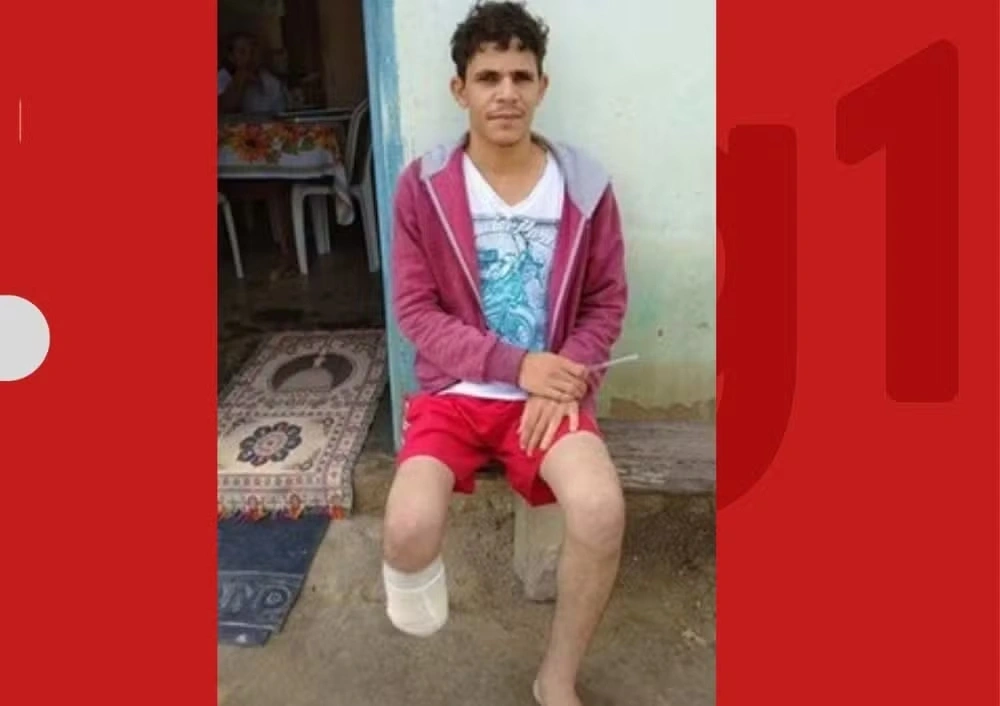 Pé de servidor que amputou o próprio membro para receber R$ 1,5 milhão foi encontrado dentro da mochila dele