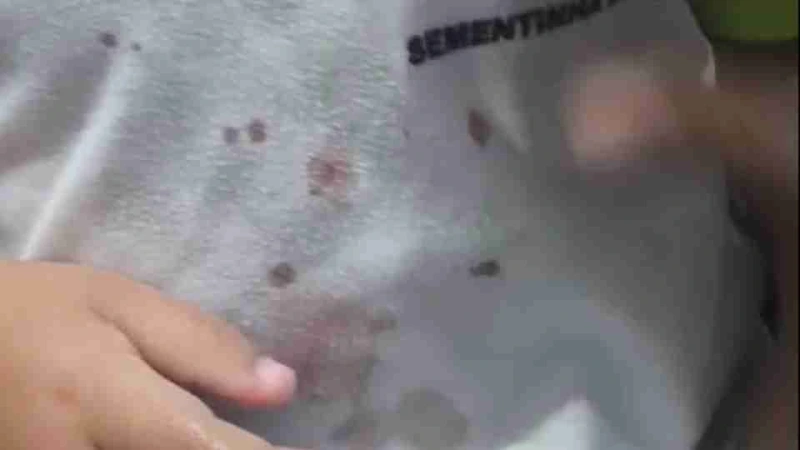Palotina - Padrasto é investigado por tortura contra menina de 2 anos